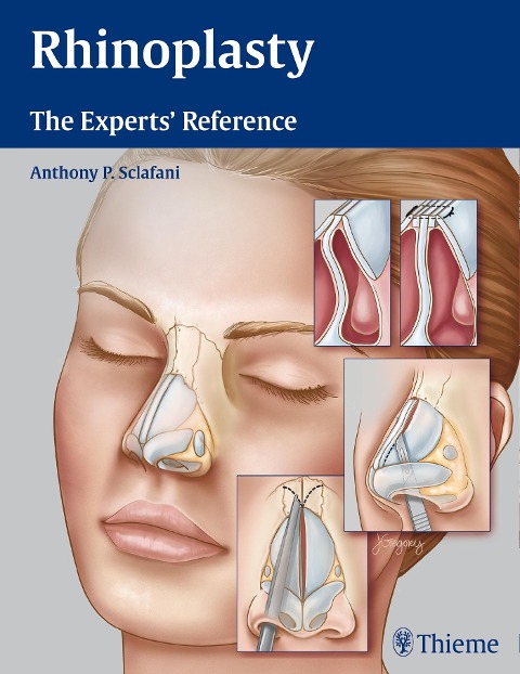 Rhinoplasty: The Experts' Reference