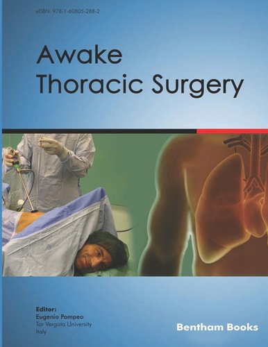 Awake Thoracic Surgery