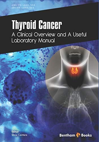 Thyroid Cancer A Clinical Overview and a Useful Laboratory Manual