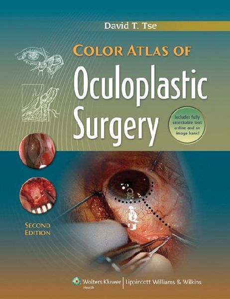 Color Atlas of Oculoplastic Surgery