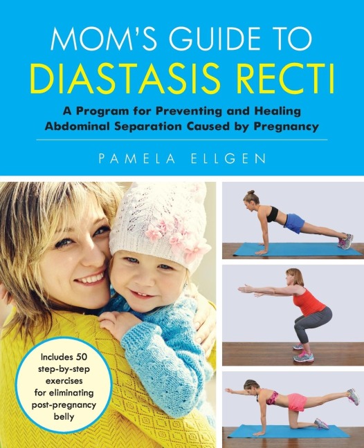 Moms Guide to Diastasis Recti: A Program for Preventing and Healing Abdominal Separation Caused by Pregnancy