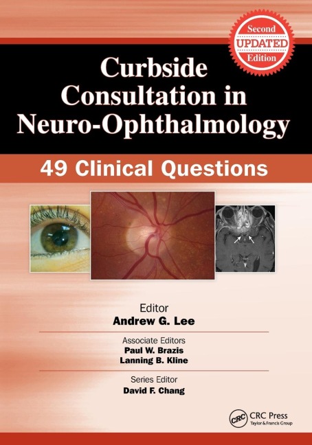Curbside Consultation in Neuro-Ophthalmology: 49 Clinical Questions