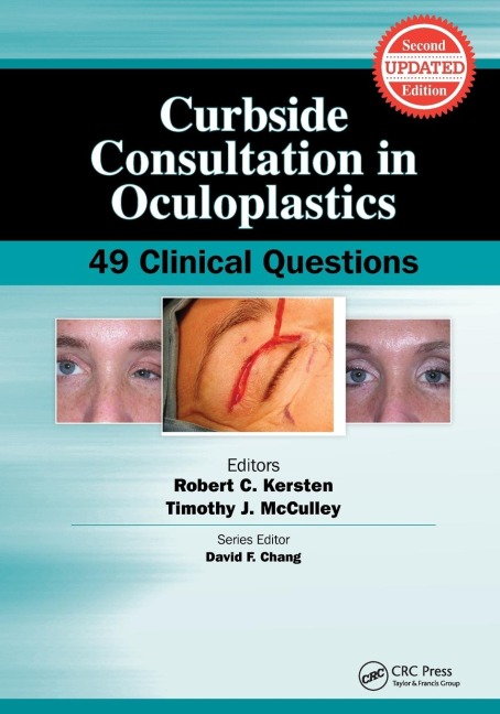 Curbside Consultation in Oculoplastics: 49 Clinical Questions