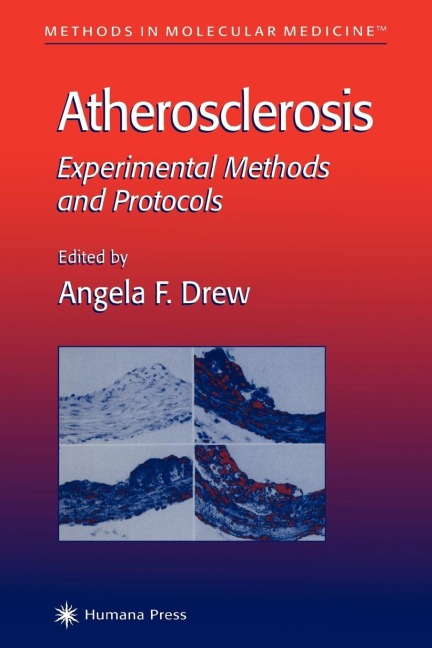 Atherosclerosis: Experimental Methods and Protocols