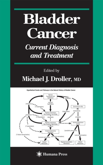 Bladder Cancer: Current Diagnosis and Treatment