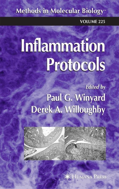 Inflammation Protocols
