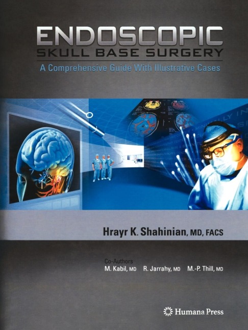 Endoscopic Skull Base Surgery: A Comprehensive Guide with Illustrative Cases