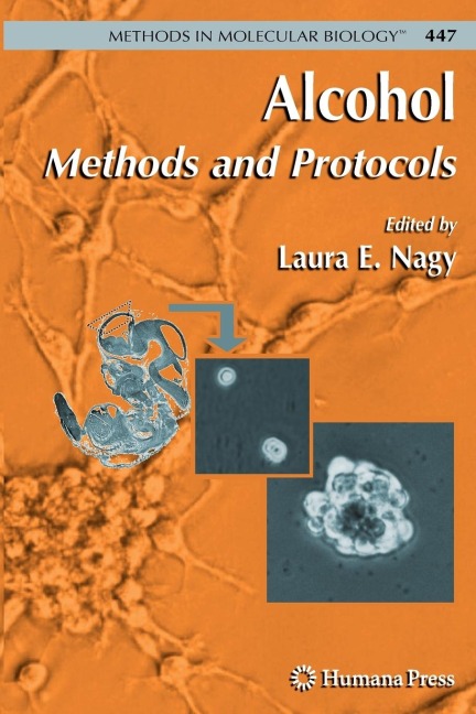 Alcohol: Methods and Protocols