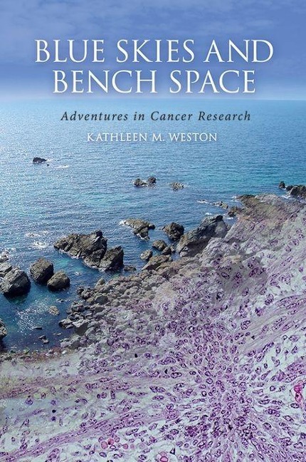 Blue Skies and Bench Space: Adventures in Cancer Research