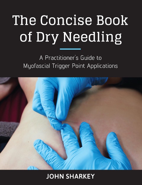 The Concise Book of Dry Needling: A Practitioners Guide to Myofascial Trigger Point Applications