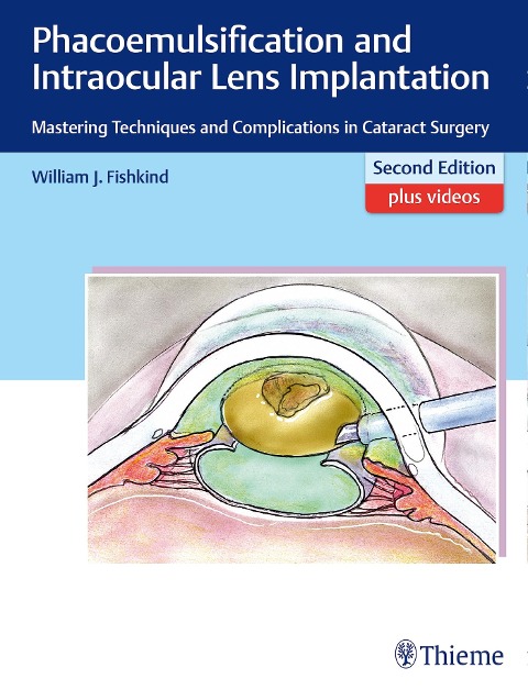 Phacoemulsification and Intraocular Lens Implantation: Mastering Techniques and Complications in Cataract Surgery