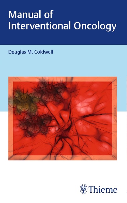 Manual of Interventional Oncology