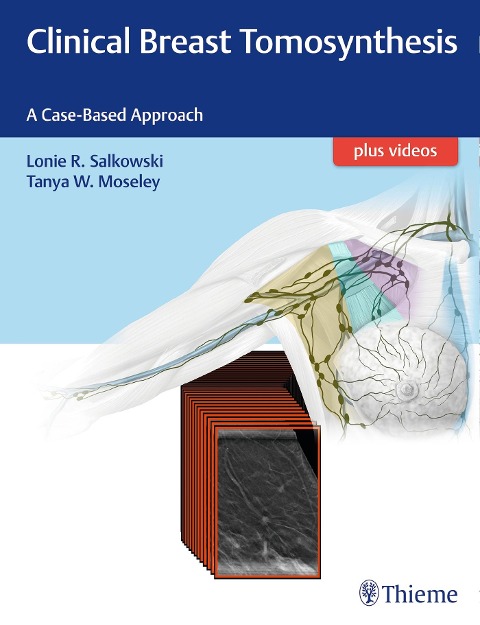 Clinical Breast Tomosynthesis: A Case-Based Approach