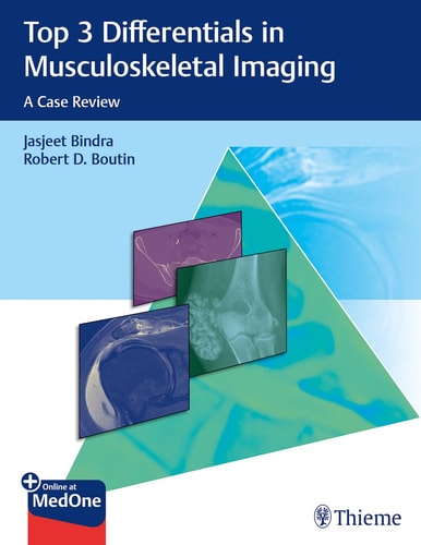 Top 3 Differentials in Musculoskeletal Imaging A Case Review