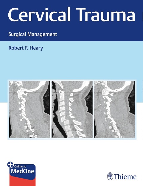 Cervical Trauma: Surgical Management