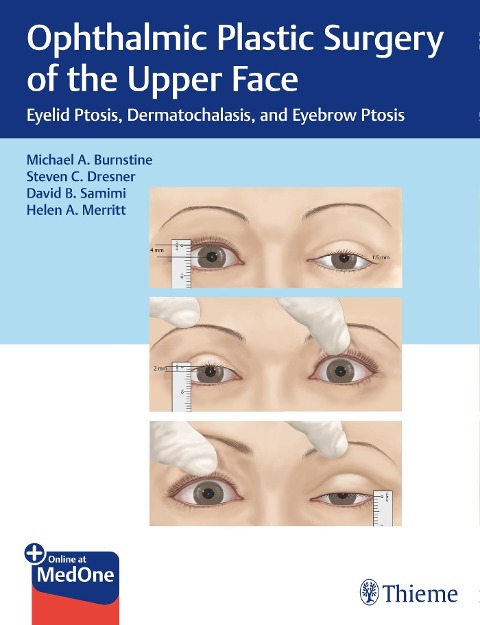 Ophthalmic Plastic Surgery of the Upper Face: Eyelid Ptosis, Dermatochalasis, and Eyebrow Ptosis