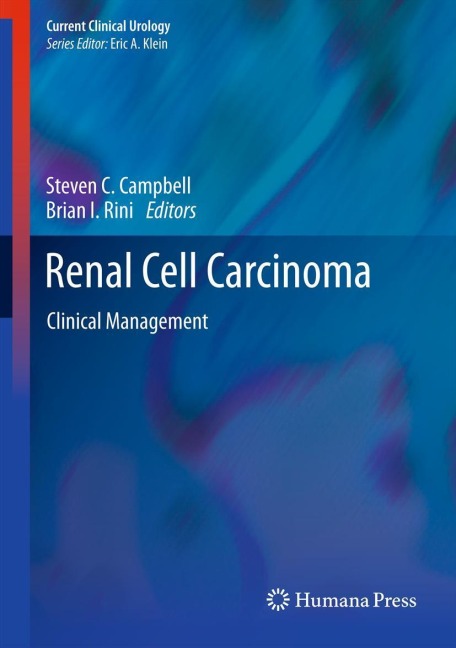 Renal Cell Carcinoma: Clinical Management