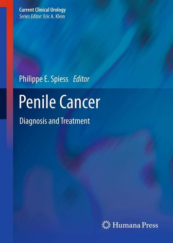 Penile Cancer Diagnosis and Treatment