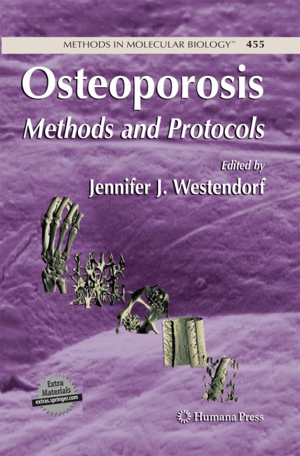 Osteoporosis: Methods and Protocols