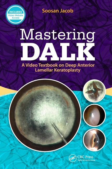 Mastering DALK: A Video Textbook on Deep Anterior Lamellar Keratoplasty