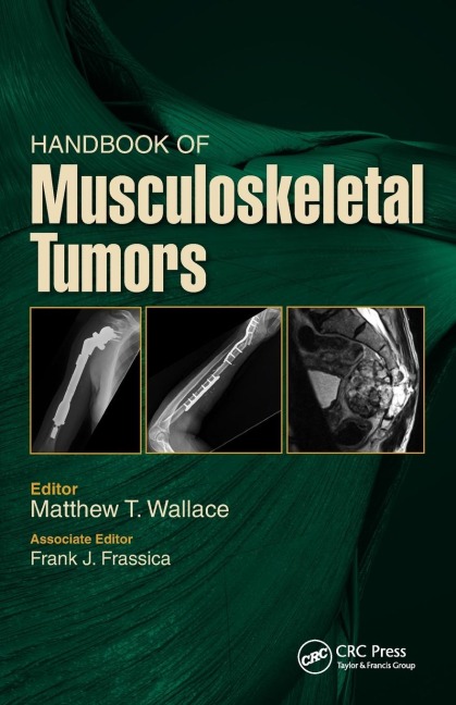 Handbook of Musculoskeletal Tumors