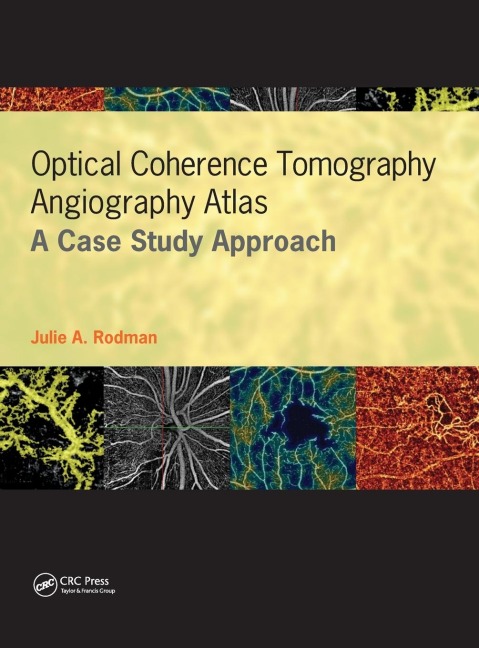 Optical Coherence Tomography Angiography Atlas: A Case Study Approach