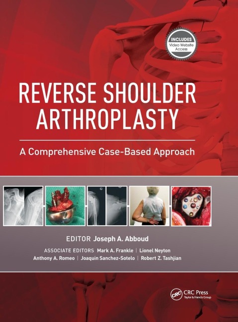 Reverse Shoulder Arthroplasty: A Comprehensive Case-Based Approach