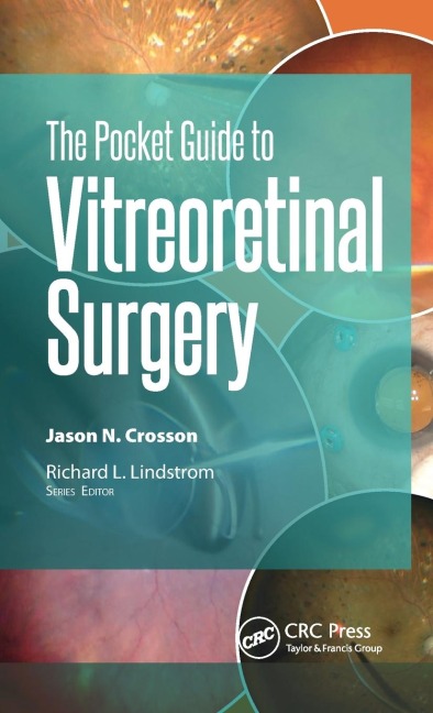 The Pocket Guide to Vitreoretinal Surgery