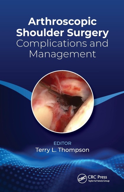 Arthroscopic Shoulder Surgery: Complications and Management