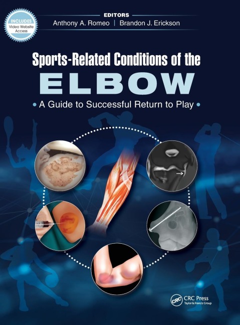 Sports-Related Conditions of the Elbow: A Guide to Successful Return to Play