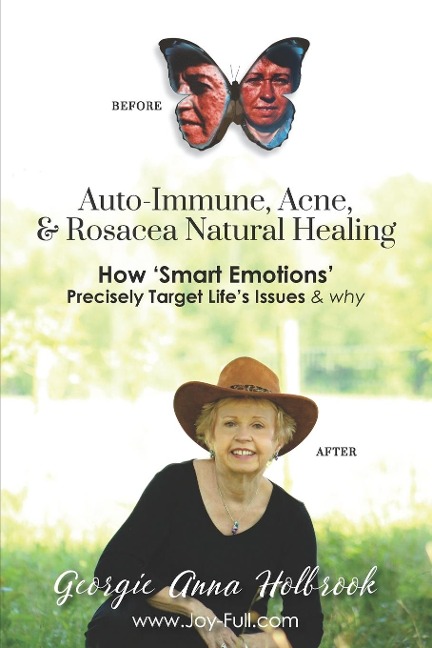 Auto-Immune, Acne, & Rosacea Natural Healing - How Smart Emotions Precisely Target Lifes Issues & Why