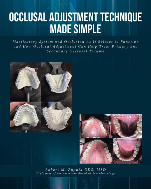 Occlusal Adjustment Technique Made Simple: Masticatory System and Occlusion As It Relates to Function and How Occlusal Adjustment Can Help Treat Primary and Secondary Occlusal Trauma