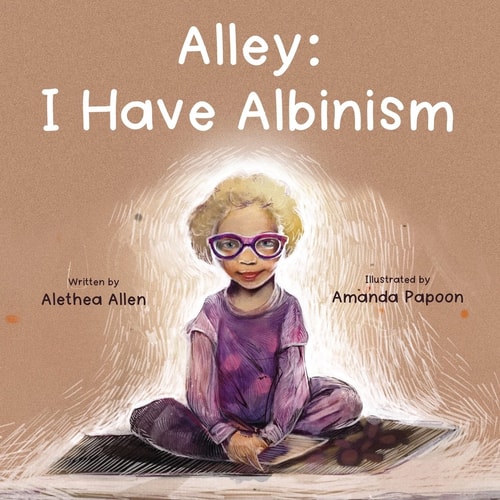 Alley I Have Albinism
