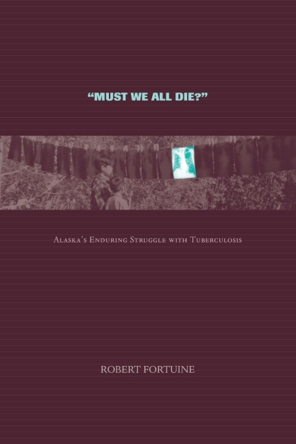 Must We All Die?: Alaskas Enduring Struggle with Tuberculosis