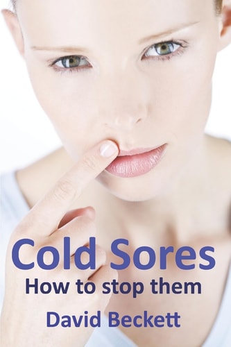 Cold Sores How to Stop Them