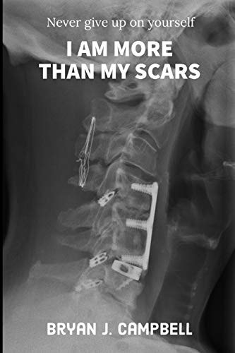 I Am More Than My Scars Never Give Up On Yourself