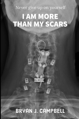 I Am More Than My Scars Never Give Up On Yourself