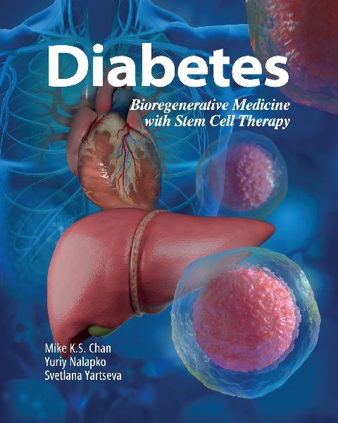 Diabetes: Bioregenerative Medicine with Stem Cell Therapy