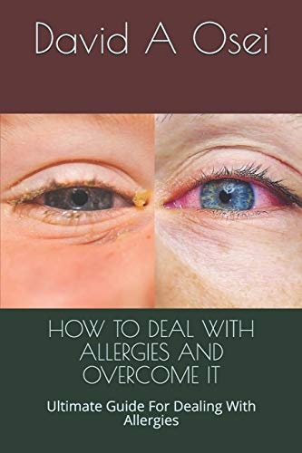 How to Deal with Allergies and Overcome It Ultimate Guide For Dealing With Allergies