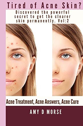TIRED of ACNE SKIN? Discover the Powerful Secrets to Get Clearer Skin Permanently