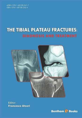 The Tibial Plateau Fractures Diagnosis and Treatmment