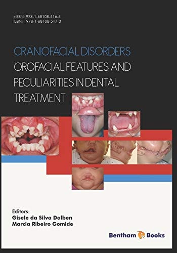 Craniofacial Disorders - Orofacial Features and Peculiarities in Dental Treatment