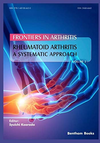 Rheumatoid Arthritis A Systematic Approach
