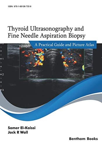 Thyroid Ultrasonography and Fine Needle Aspiration Biopsy A Practical Guide and Picture Atlas