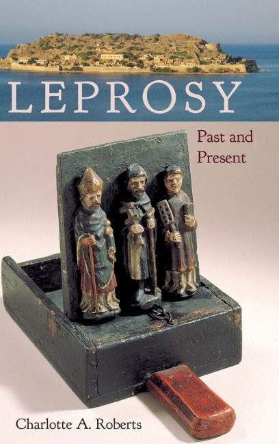 Leprosy: Past and Present