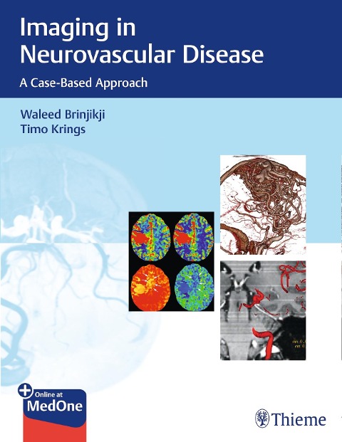 Imaging in Neurovascular Disease: A Case-Based Approach