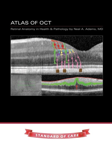 Atlas of OCT Retinal Anatomy in Health & Pathology