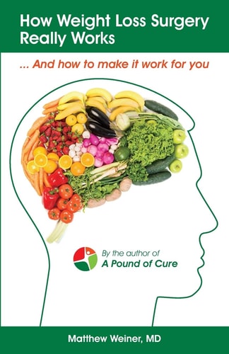 How Weight Loss Surgery Really Works And How to Make It Work for You