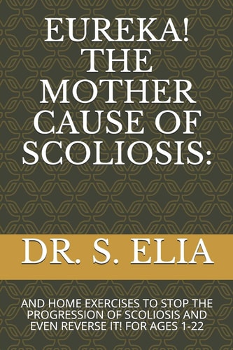 Eureka! the Mother Cause of Scoliosis And Home Exercises to Stop the Progression of Scoliosis and Even Reverse It! for Ages 1-22