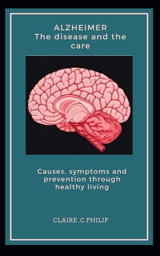 Alzheimer The Disease and the Care Causes, Symptoms and Prevention Through Healthy Living.